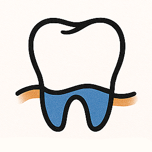 Tooth & Gum Contouring